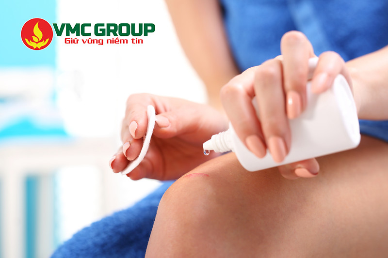 Oxy già có tính sát khuẩn cao