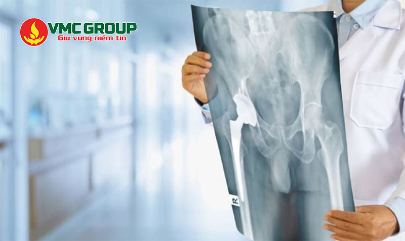 Barium sulfate được dùng trong chụp X-quang đường tiêu hóa