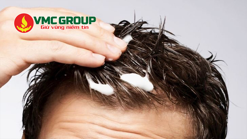Povidone K30 được dùng trong nhiều sản phẩm tạo kiểu cho tóc
